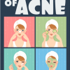 getting rid of acne ebook